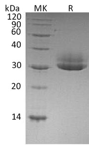 Recombinant Human CTRL (C-6His)