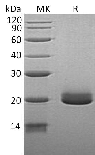 Recombinant Human EFNA4 (C-6His)