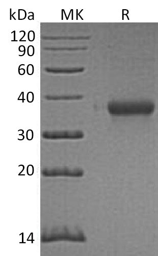 Recombinant Human EFNA3 (C-6His)