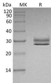 Recombinant Human JAM-A (C-6His)