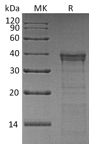 Recombinant Human CTSL2 (C-6His)
