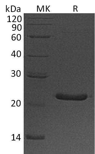 Recombinant Human CSH1 (C-6His)