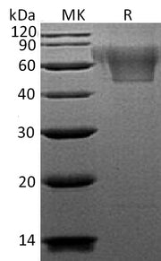 Recombinant Human CX3CL1 (C-6His)