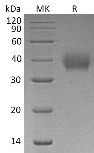 Recombinant Human FcAR (C-6His)