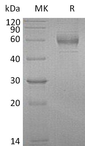Recombinant Human GFRA1 (C-6His)