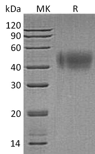 Recombinant Human IFNAR2 (C-6His)
