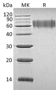 Recombinant Human LYPD3 (C-6His)