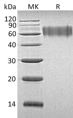Recombinant Human LYPD3 (C-6His)