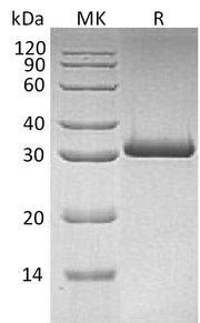 Recombinant Human MBL-2 (C-6His)