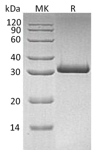 Recombinant Human MBL-2 (C-6His)