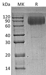 Recombinant Human LAMP2 (C-6His)