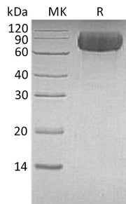 Recombinant Human LILRB1 (C-6His)