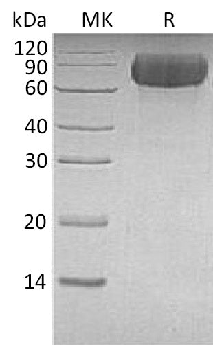 Recombinant Human LILRB1 (C-6His)