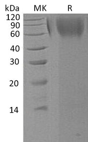 Recombinant Human LAMP1 (C-6His)
