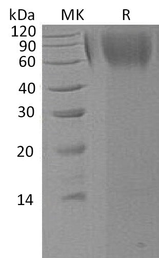 Recombinant Human LAMP1 (C-6His)