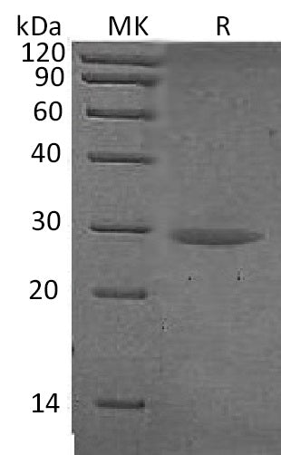 Recombinant Human CTRB1 (C-6His)