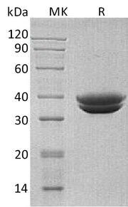 Recombinant Human GPA33 (C-6His)