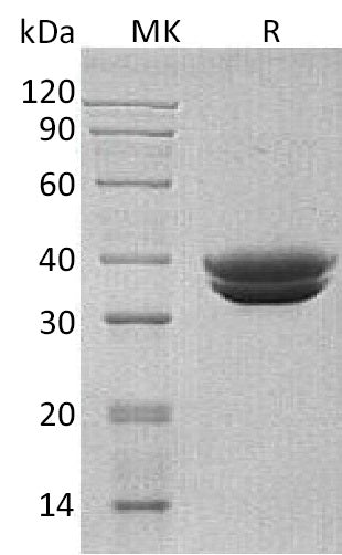 Recombinant Human GPA33 (C-6His)