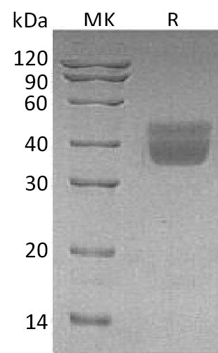 Recombinant Human KLK1 (C-6His)