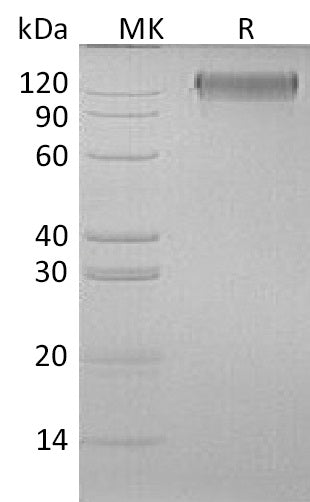 Recombinant Human OSMRB (C-6His)
