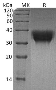Recombinant Human TREM-1 (C-6His)