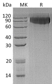 Recombinant Human GPNMB (C-6His)