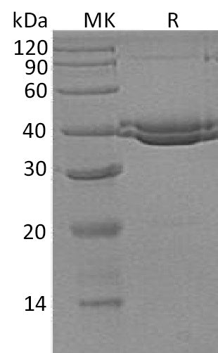Recombinant Human SUMF1 (C-6His)