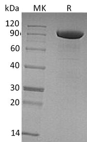 Recombinant Human Tie-1 (C-6His)