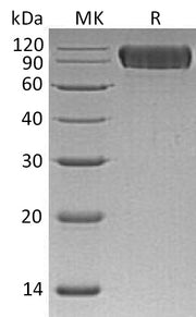 Recombinant Human NLGN1 (C-6His)