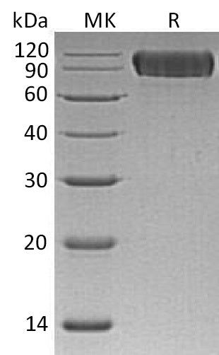 Recombinant Human NLGN1 (C-6His)