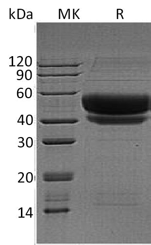 Recombinant Human ST6GAL1 (C-6His)