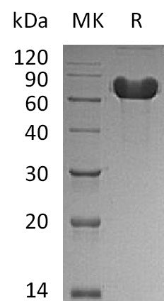 Recombinant Human GOLM1 (C-6His)