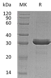Recombinant Human HDGFRP3 (C-6His)