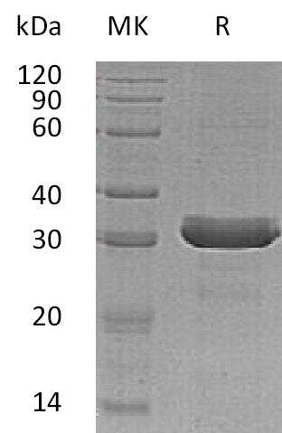 Recombinant Human HDGFRP3 (C-6His)