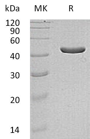 Recombinant Human IDH1 (C-6His, Mammalian)