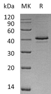 Recombinant Human CAMK1 (C-6His)