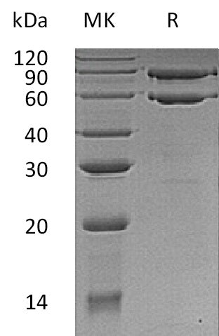 Recombinant Human COL8A1 (C-6His)