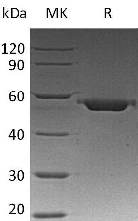 Recombinant Human VDB (C-6His)