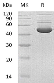 Recombinant Human HMBS (C-6His)