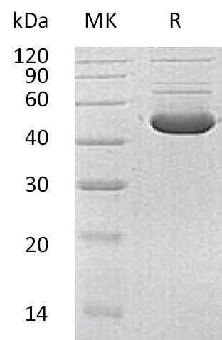 Recombinant Human HMBS (C-6His)
