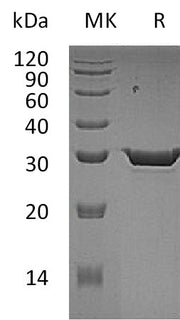 Recombinant Human HPGD (C-6His)