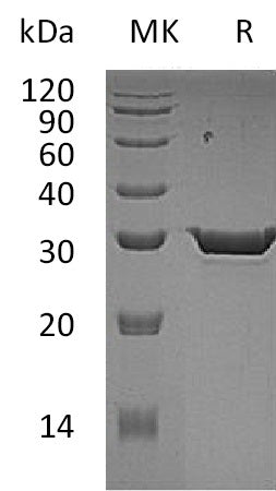 Recombinant Human HPGD (C-6His)
