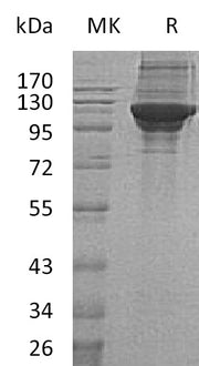 Recombinant Human KARS (C-6His)