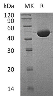 Recombinant Human FAH (C-6His)