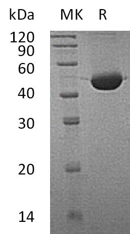 Recombinant Human FAH (C-6His)