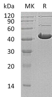 Recombinant Human ADH7 (C-6His)