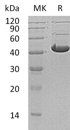 Recombinant Human ADH7 (C-6His)