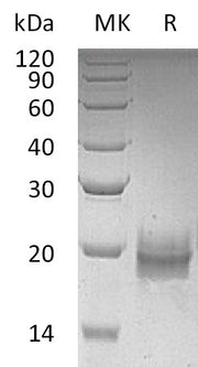 Recombinant Human TFF2 (C-6His)