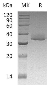 Recombinant Human LGALS3 (C-6His)