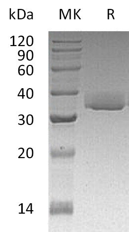 Recombinant Human LGALS3 (C-6His)
